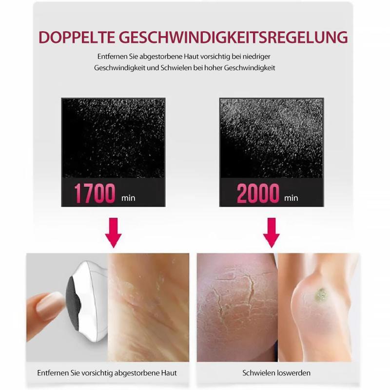 Elektrischer Hornhautentferner für Füße und Hände